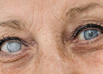 Are You at Risk of This Eyesight-Robbing Disease?