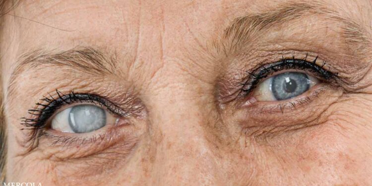 Are You at Risk of This Eyesight-Robbing Disease?