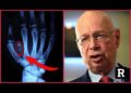 Hang on! Klaus Schwab is getting AWAY with this? | Redacted with Natali and Clayton Morris