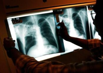 Illegal Immigrant Children With Tuberculosis Released Across US