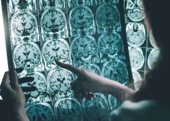 Lilly Drug Slows Alzheimer’s Progression by 60 Percent