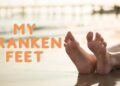 My Franken Feet