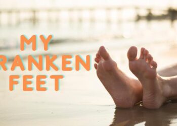 My Franken Feet