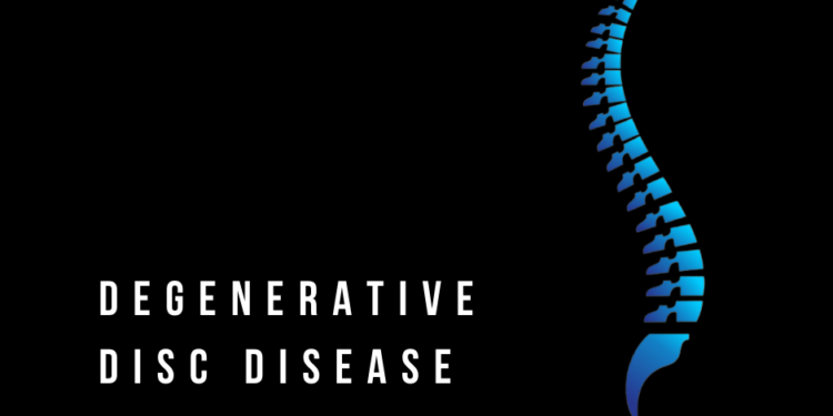 Two Treatment Approaches for Degenerative Disk Disease (DDD)