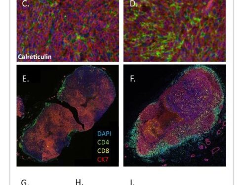 Ivermectin stimulates T-cells to invade and destroy tumors, which is what the immune system SHOULD be doing. Cancer grow…