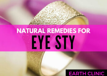 Top 10 Natural Treatments for Eye Styes