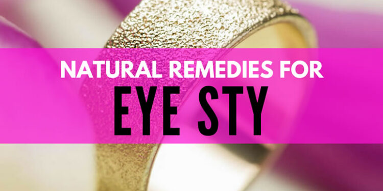 Top 10 Natural Treatments for Eye Styes